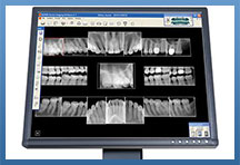 Digital Dental X-rays Fullerton CA