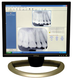 Low Radiation Dental X-rays Fullerton CA